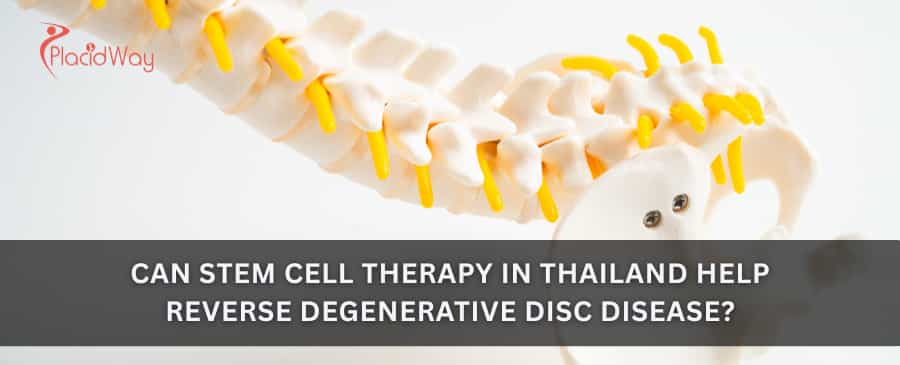 Can stem cell therapy in Thailand help reverse degenerative disc disease?