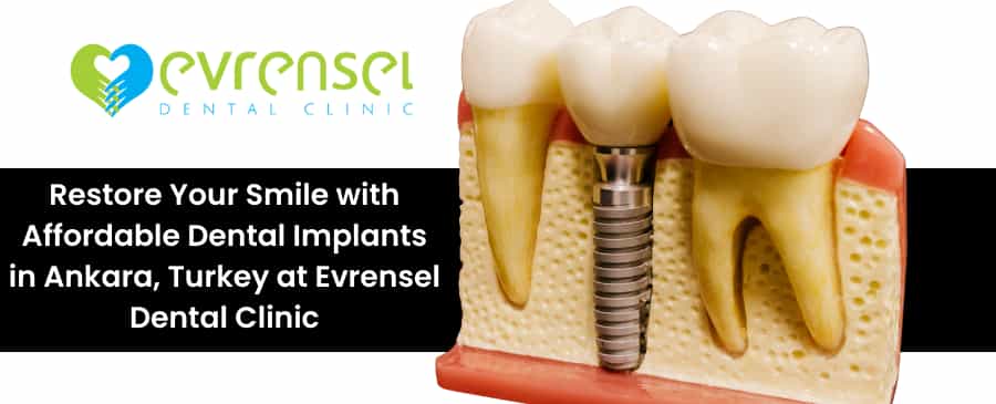 dental implants in Turkey
