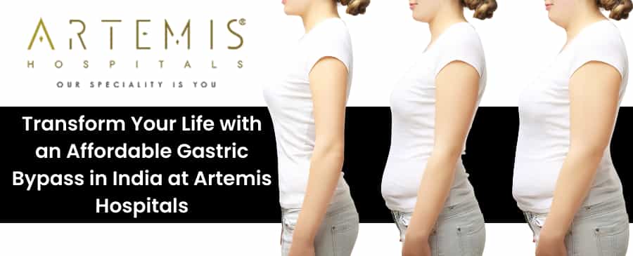 gastric bypass in India