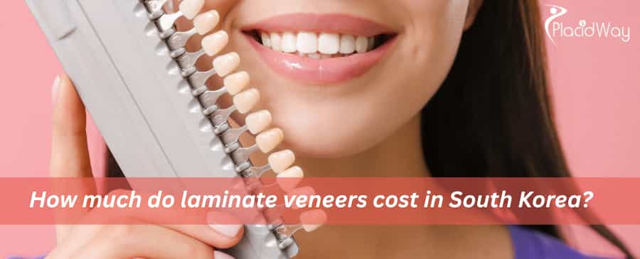 laminate veneers cost in South Korea