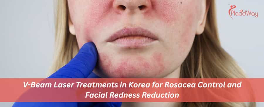 V-Beam Laser Treatments in Korea 