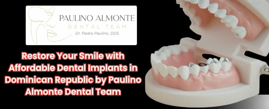 All on 6 Dental Implants in Dominican Republic