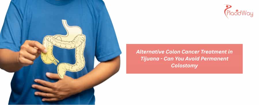Alternative Colon Cancer Treatment in Tijuana 