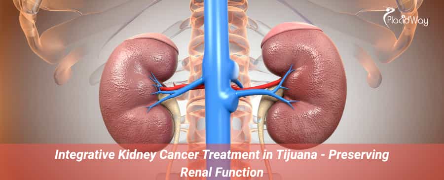 Integrative Kidney Cancer Treatment in Tijuana 