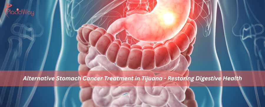 Alternative Stomach Cancer Treatment in Tijuana 