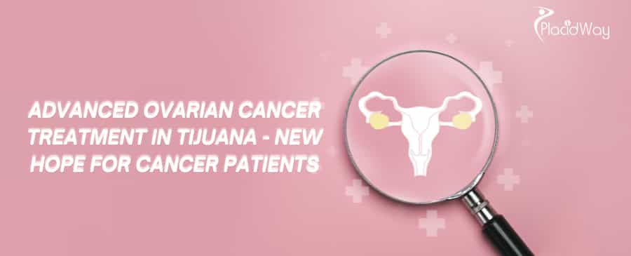 Advanced Ovarian Cancer Treatment in Tijuana