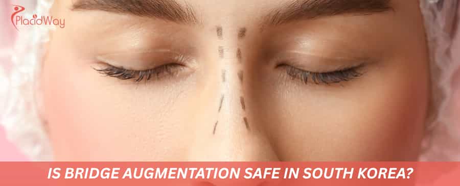 Is bridge augmentation safe in South Korea?
