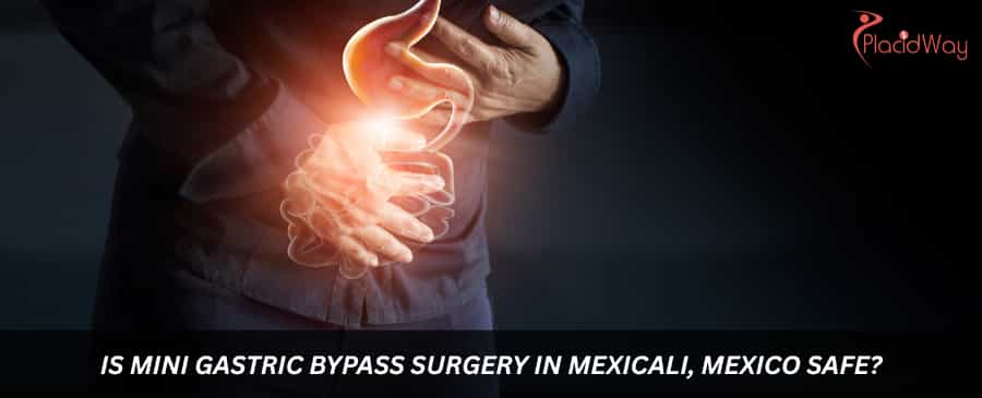 Is mini gastric bypass surgery in Mexicali, Mexico safe?