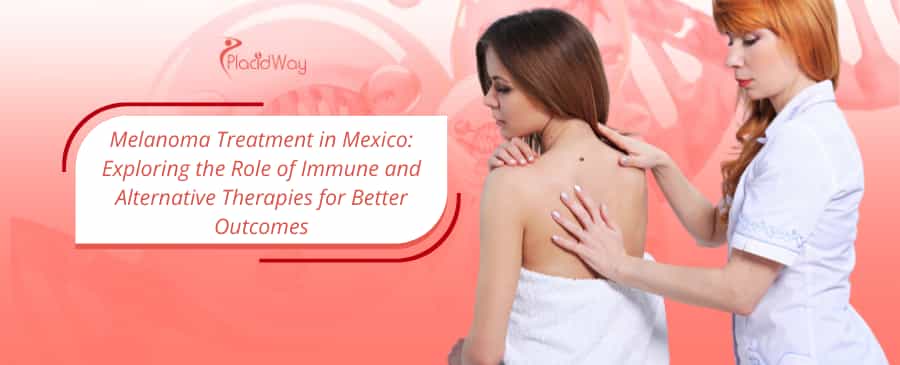 Melanoma Treatment in Mexico