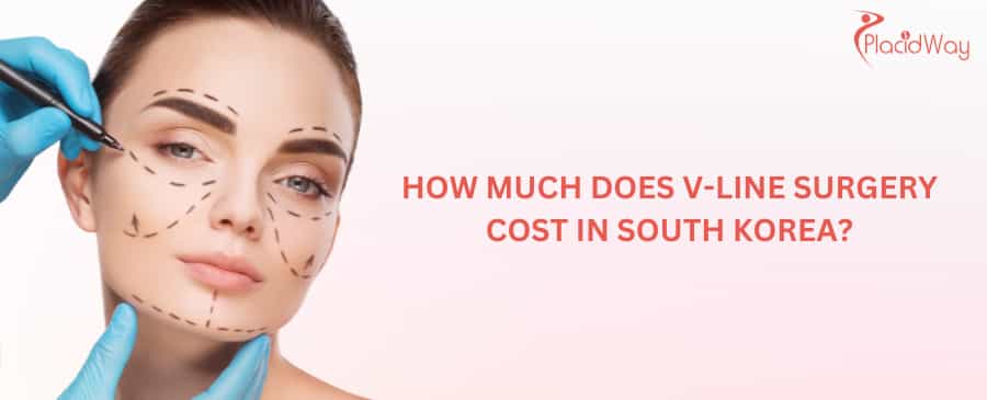 How much does V-Line surgery cost in South Korea?