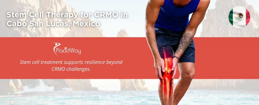 Terapia con células madre para CRMO en Cabo San Lucas, México