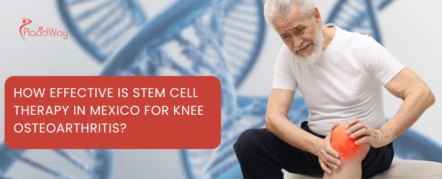 How effective is stem cell therapy in Mexico for knee osteoarthritis?
