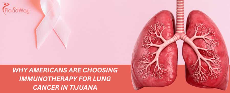 Immunotherapy for Lung Cancer in Tijuana