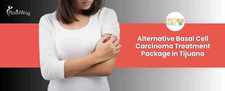 Paquete de tratamiento alternativo para el carcinoma basocelular en Tijuana, México, por ITC.