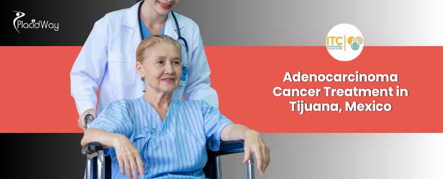 Paquete de tratamiento alternativo para el adenocarcinoma en Tijuana, México, ofrecido por ITC.