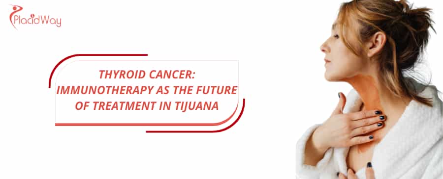 Thyroid Cancer: Immunotherapy as the Future of Treatment in Tijuana