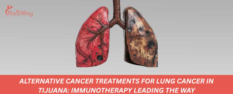 Alternative Cancer Treatments for Lung Cancer in Tijuana