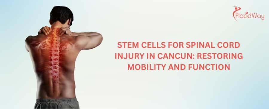 Stem Cells for Spinal Cord Injury in Cancun
