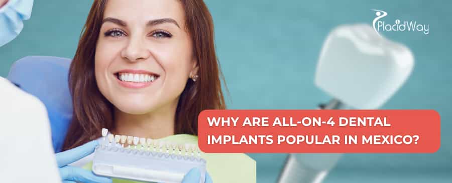 Why are All-on-4 dental implants popular in Mexico?