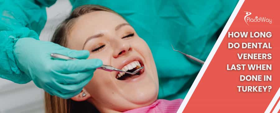 How long do dental veneers last when done in Turkey?