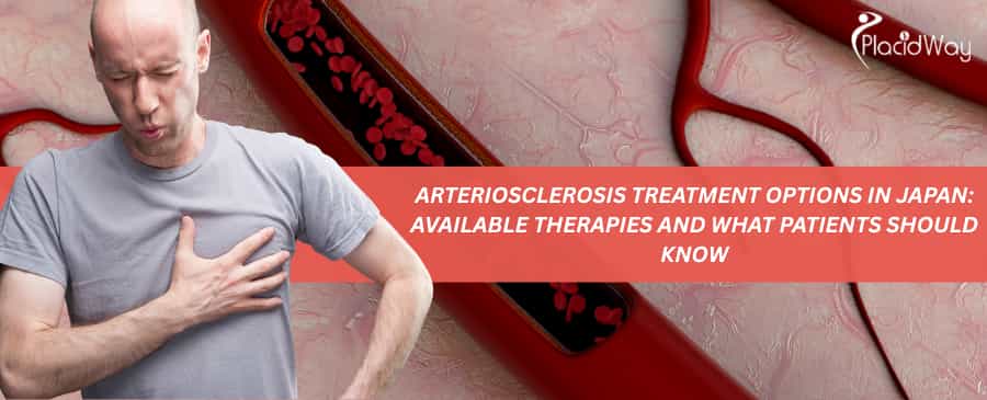 Arteriosclerosis Treatment Options in Japan
