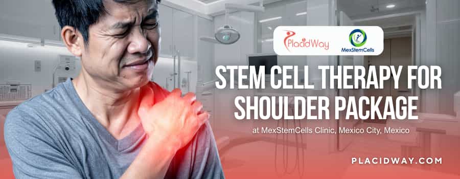 Stammzellentherapie für die Schulter in Mexiko-Stadt | MexStemCells Klinik