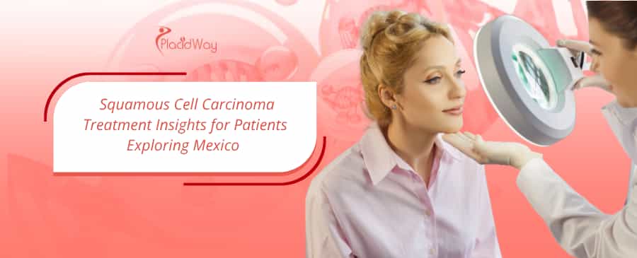 Squamous Cell Carcinoma Treatment