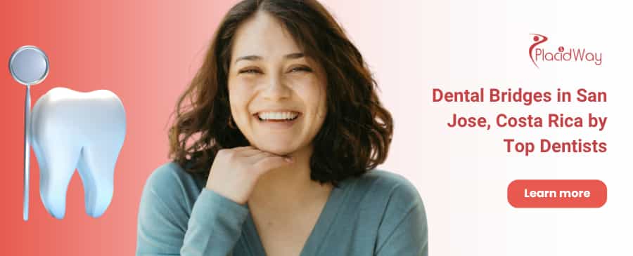 Dental Bridges in San Jose, Costa Rica by Top Dentists