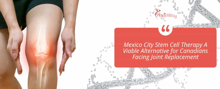 Mexico City Stem Cell Therapy A Viable Alternative for Canadians Facing Joint Replacement