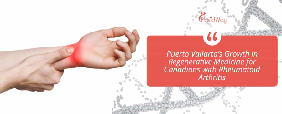 Puerto Vallarta’s Growth in Regenerative Medicine for Canadians with RA