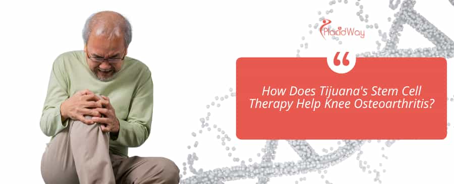 Faster Recovery Without Surgery Tijuana’s Stem Cell Protocols Attract Canadian Patients