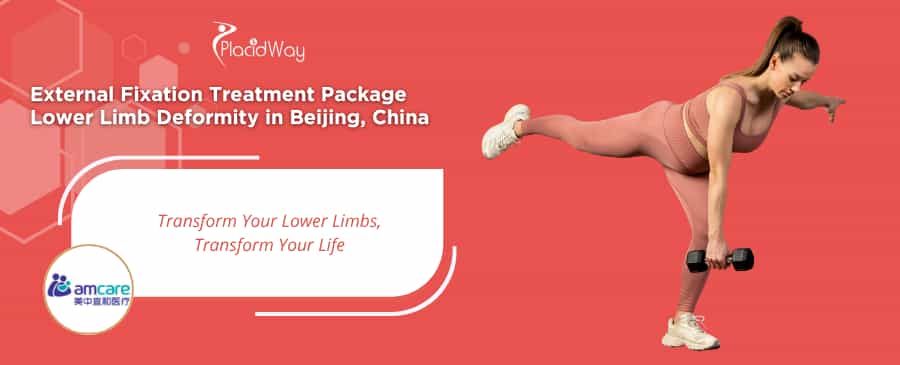 علاج التثبيت الخارجي لتشوهات الأطراف السفلية المعقدة في بكين
