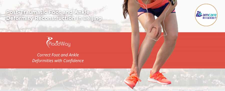 إعادة بناء تشوهات القدم والكاحل بعد الإصابة في بكين، الصين