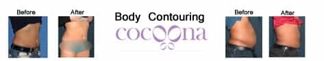 Body Contour
