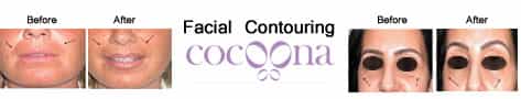 Contour