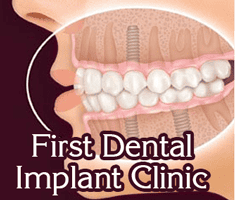 First Dental Implant Clinic