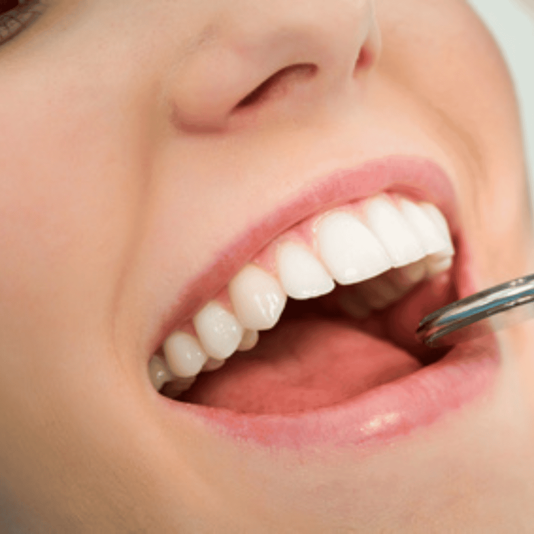 What is the cost advantage of dental treatment abroad