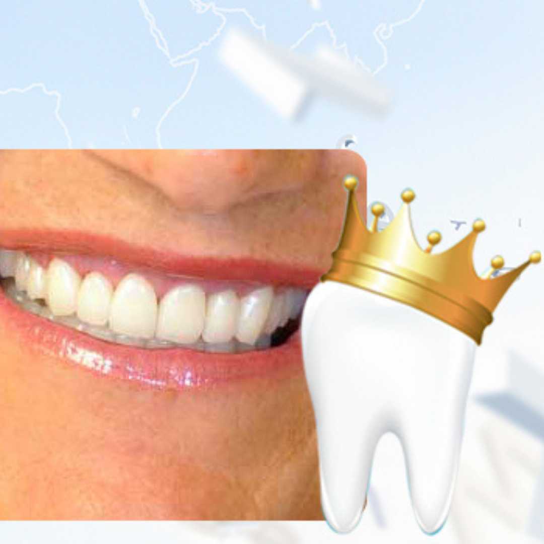 Most Desired Treatment of Dental Crowns in Cali, Colombia