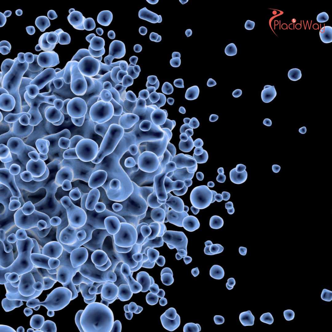 Why CAR T-Cell Therapy is Gaining Attention for Autoimmune Diseases