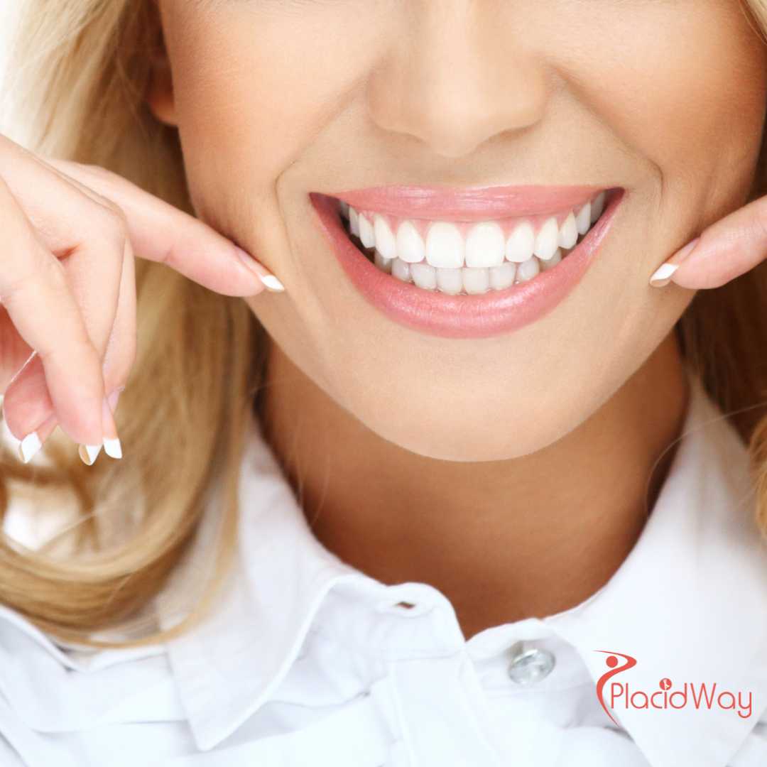 Step-by-Step Guide for Australians Planning All-on-4 Dental Implant Trips to Vietnam 