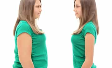 Monica's Journey to Health and Confidence with Bariatric Surgery in Turkey