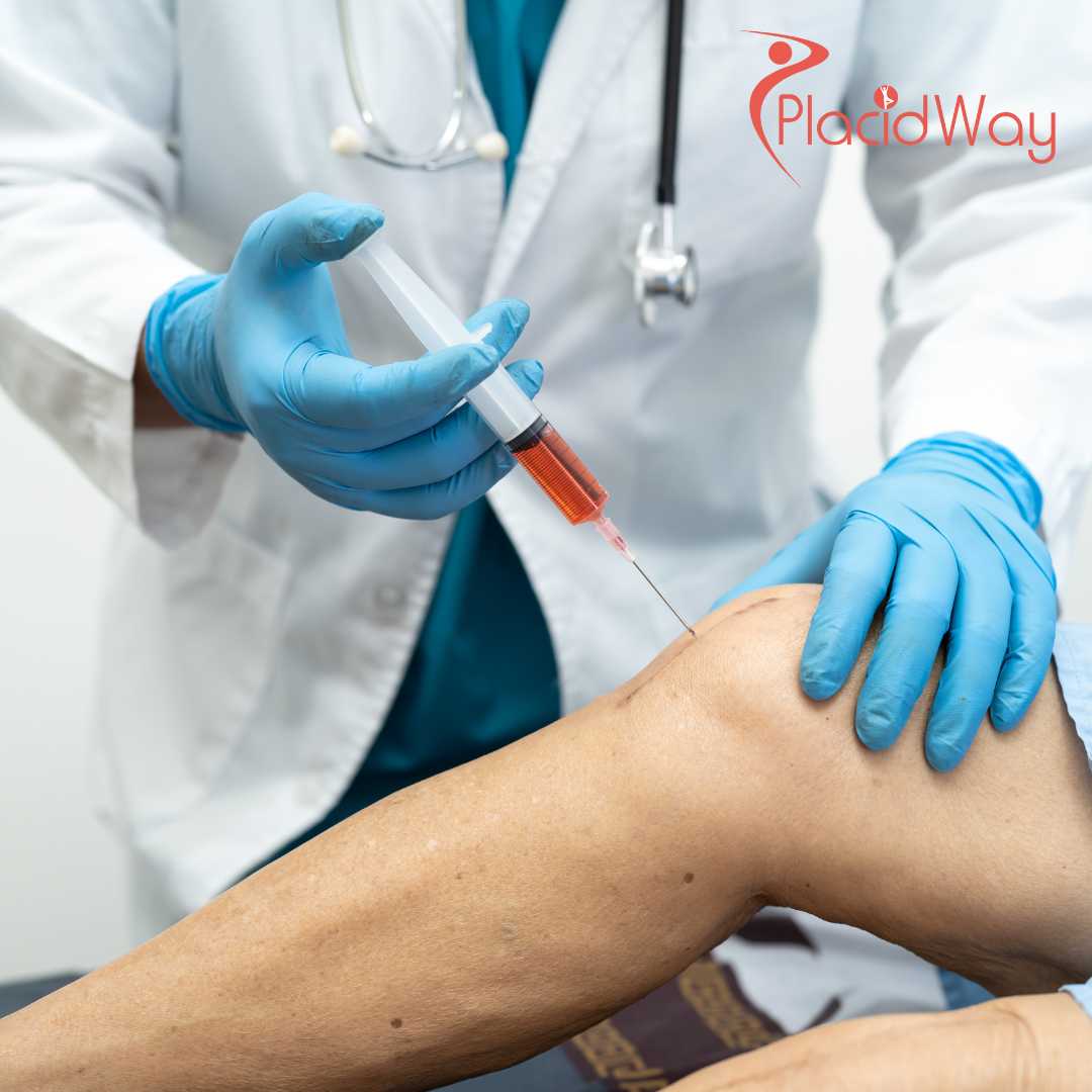 How Canadians Can Save on Stem Cell Therapy for Osteoarthritis by Traveling to Mexico