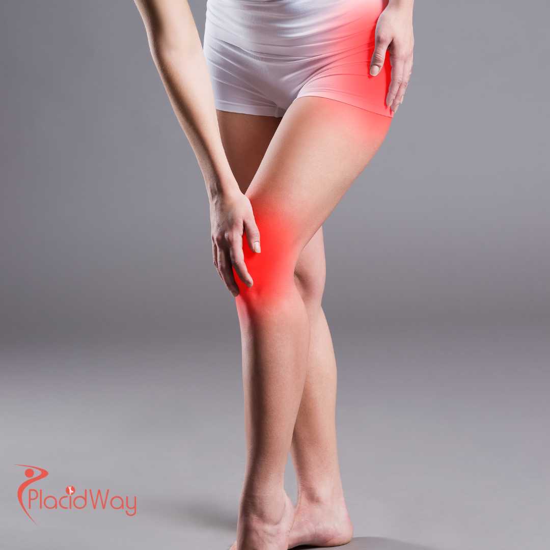 Stem Cell Therapy for Arthritis in Thailand: Cutting-Edge Treatment Options for Australian Patients