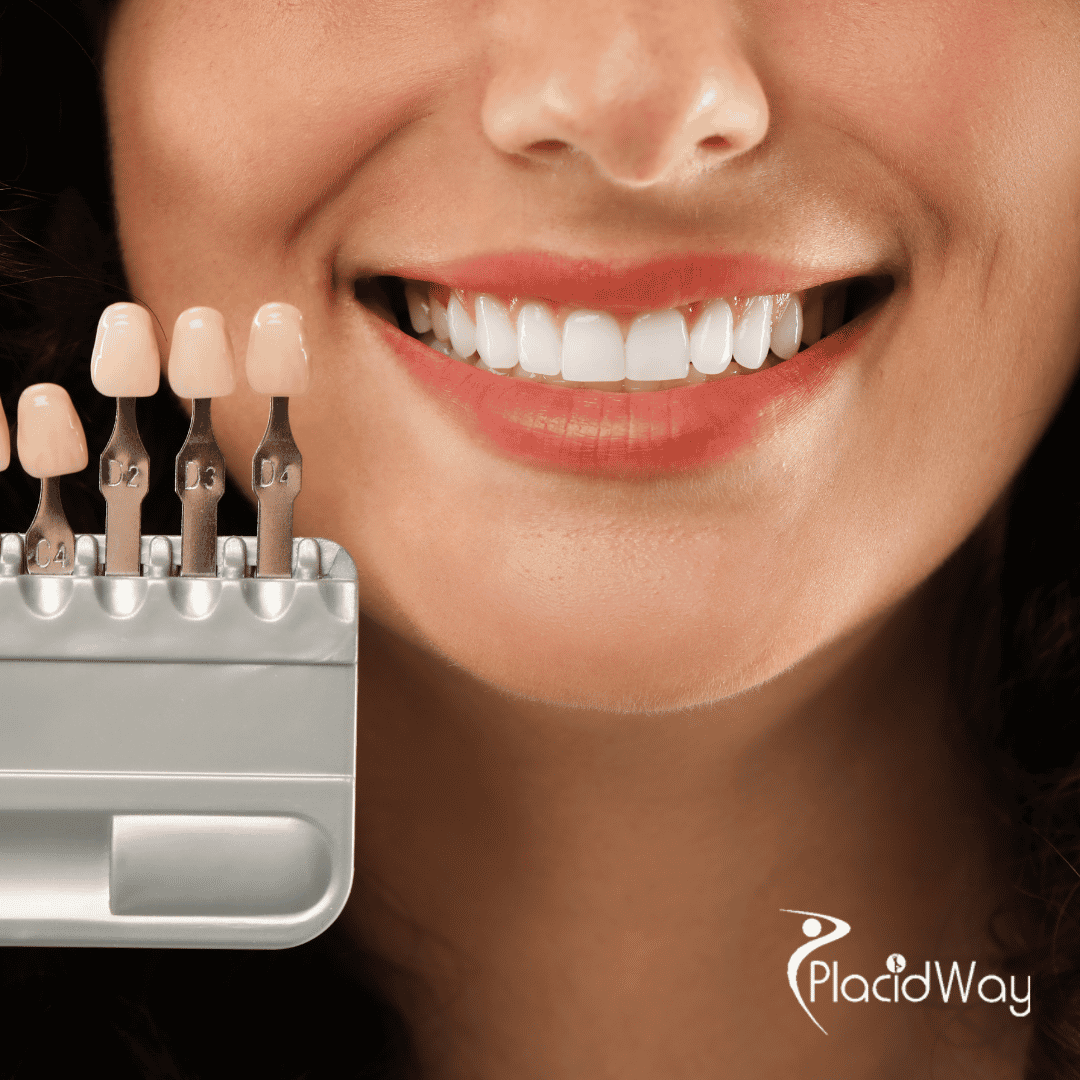 Zirconia Crowns in Turkey:  Why UK Patients are Choosing Them Over Porcelain