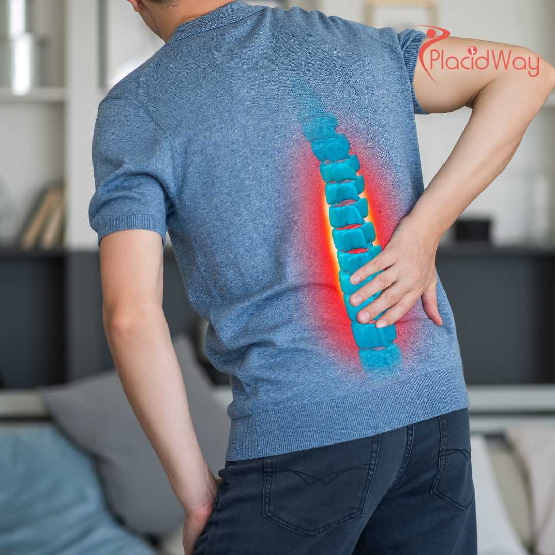 Spinal Fusion in Turkey: A Patient's Guide to Top Hospitals and Neurosurgeons