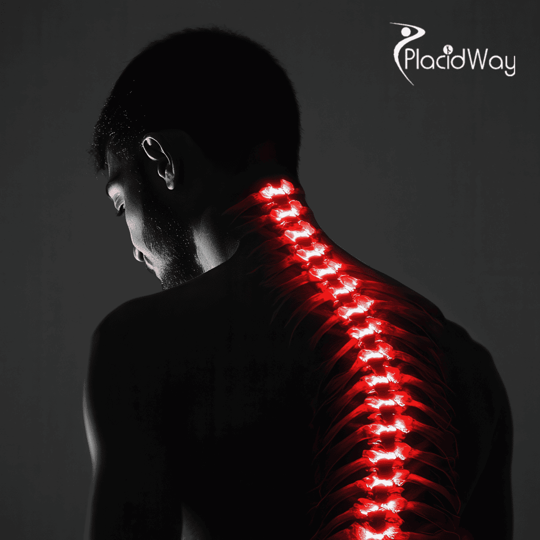 Spinal Cord Injury Stem Cell Therapy in Colombia: Low-Cost, Effective Solutions for Georgia Patients