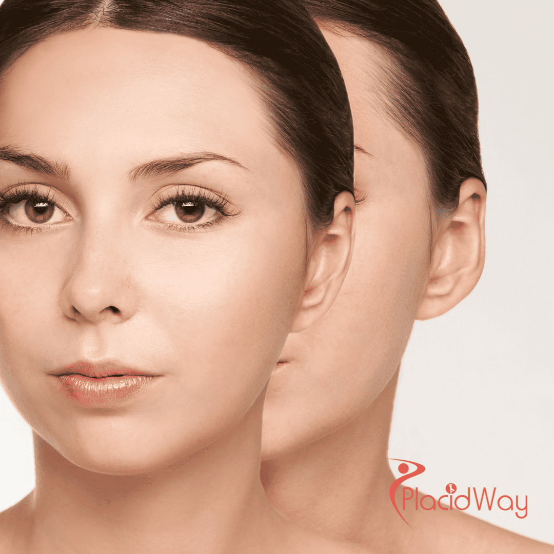 Otoplasty in Turkey: An Affordable Option for UK Patients
