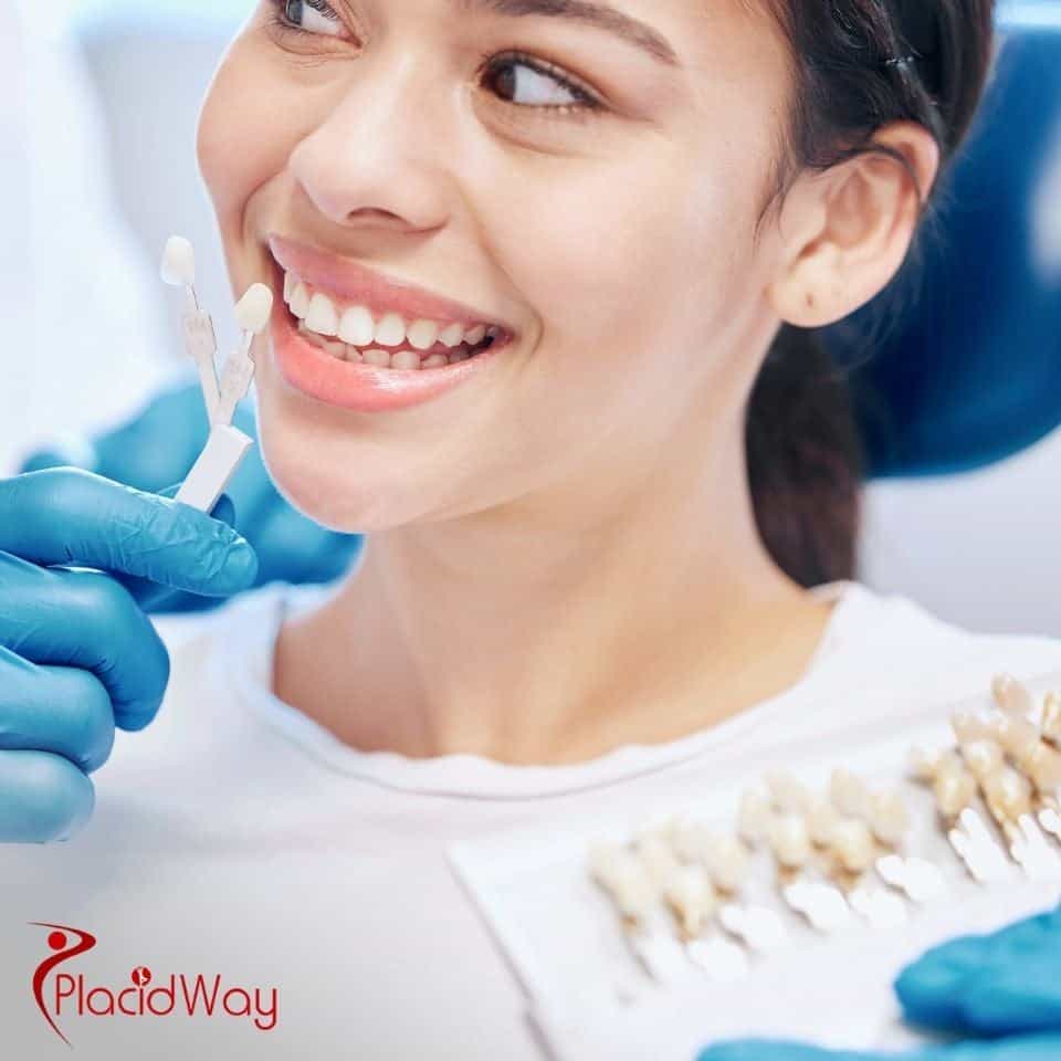 Veneers in Costa Rica: Affordable Cosmetic Dentistry for California Tourists