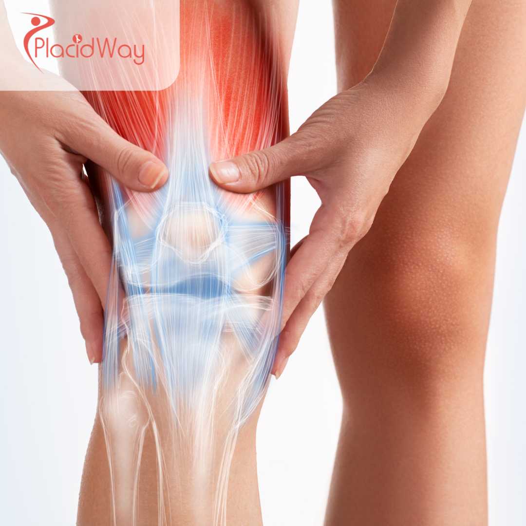Knee Replacement Surgery in Mexico: High-Quality, Affordable Joint Surgery for Texas Patients