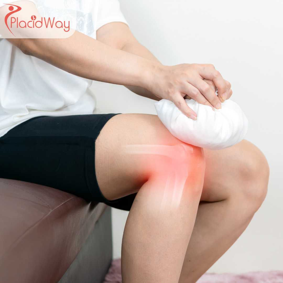Stem Cell Therapy for Osteoarthritis in Turkey: Costs and Options for UK Patients